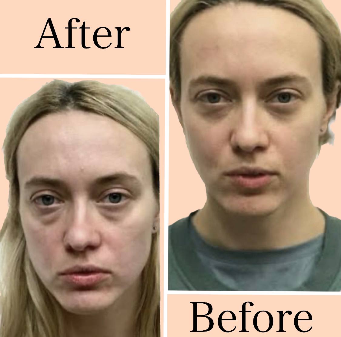 NimbleLife™ Anti-Aging Eye Massager Eyes Fatigue Relief Relaxation Relieve Dark Circles EMS Eye Care Massage