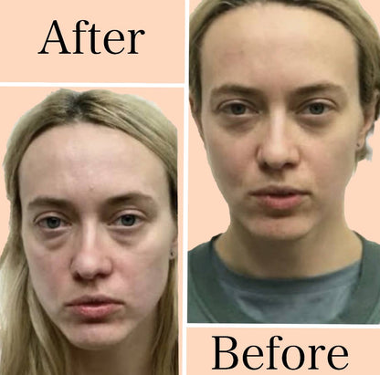 NimbleLife™ Anti-Aging Eye Massager Eyes Fatigue Relief Relaxation Relieve Dark Circles EMS Eye Care Massage